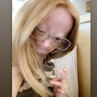 Adalia Rose