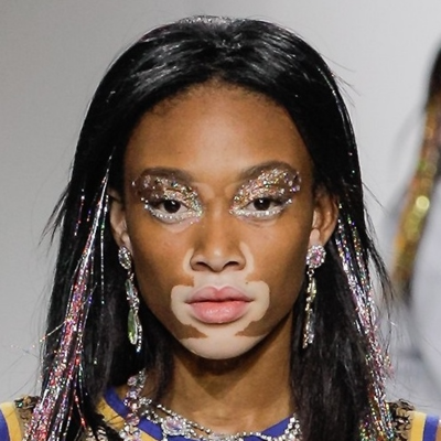 Winnie Harlow